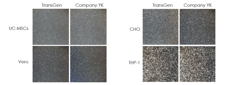 使用TransGen 凍存液和Company YK 無DMSO 無蛋白凍存液在-80℃凍存1 個月的多種細胞復(fù)蘇24 小時后細胞貼壁情況的比較